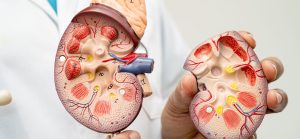 Chronic Kidney Disease (CKD): causes, risk factors, and CKD stages explained. 